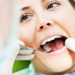Tooth Extraction