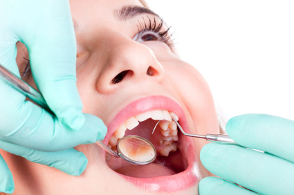 How Composite Fillings in Highland, MI Reinvent Your Smile
