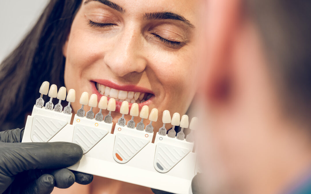 Can You Take the Veneers Off? What You Need to Know Before Getting Them