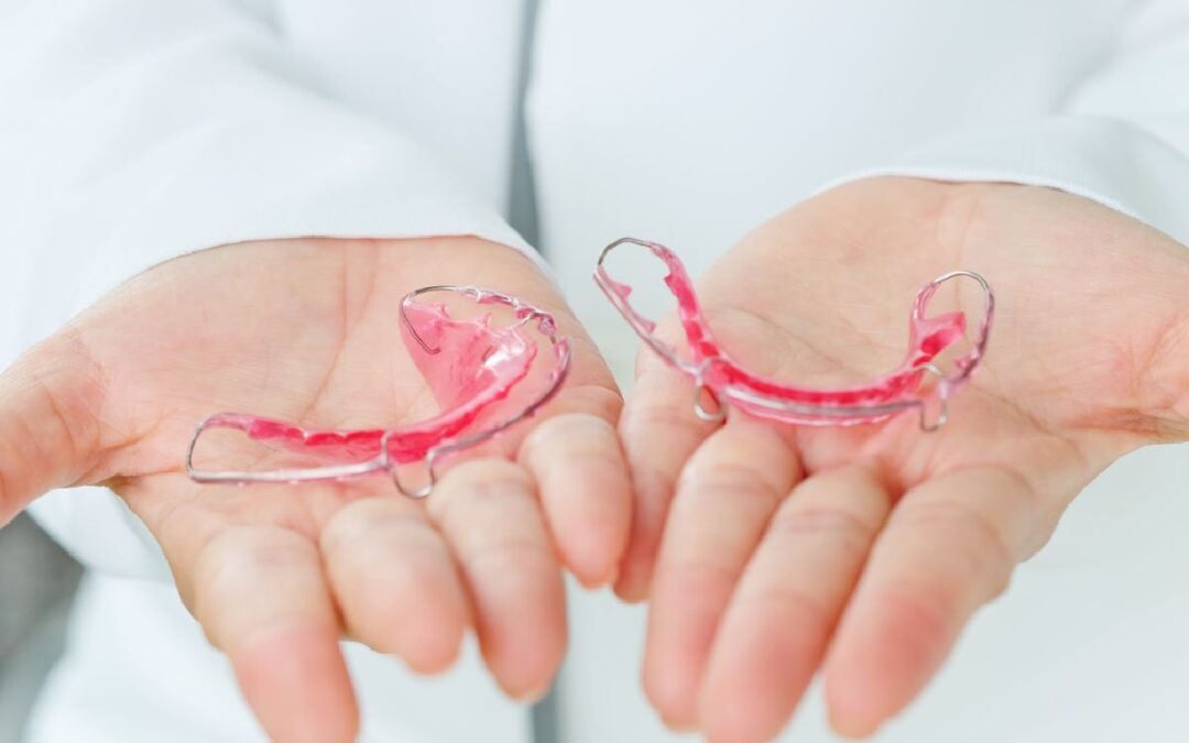 Do You Have to Wear Retainers Forever After Braces?