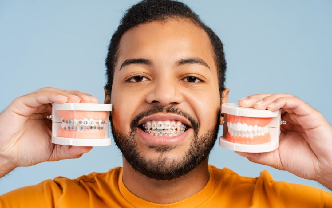 What Is Better: Invisalign or Braces?