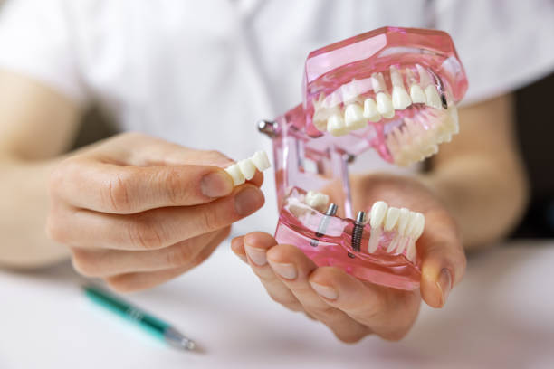 Advanced Dental Implant